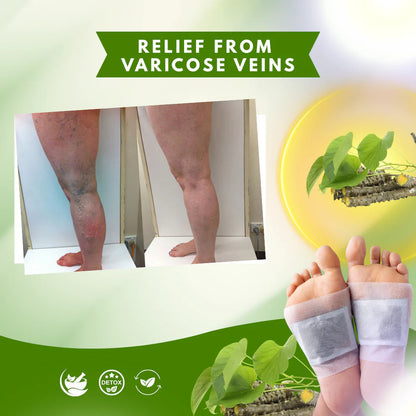 Ayur Glow Fix Giloy 💚🌿 (Buy 10 Get 10 Free🔥🔥)