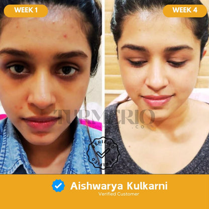 Turmeric & Kojic Acid Cleansing Pads (50 Pads)