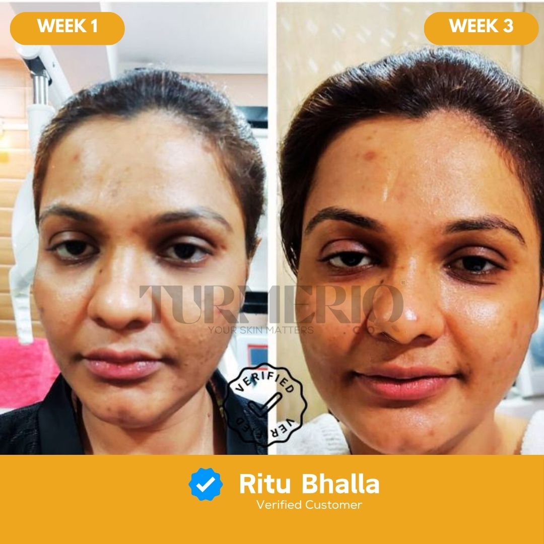 Turmeric & Kojic Acid Cleansing Pads (50 Pads)